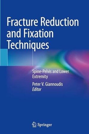 Fracture Reduction and Fixation Techniques: Spine-Pelvis and Lower Extremity PDF