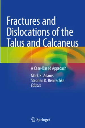 Fractures and Dislocations of the Talus and Calcaneus PDF