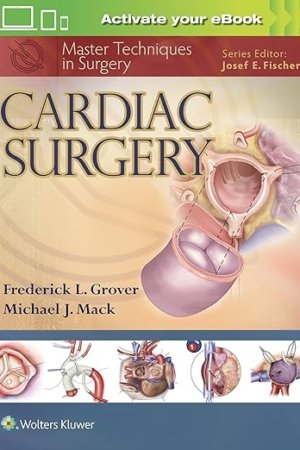 Cardiac Surgery (Master Techniques in Surgery) PDF