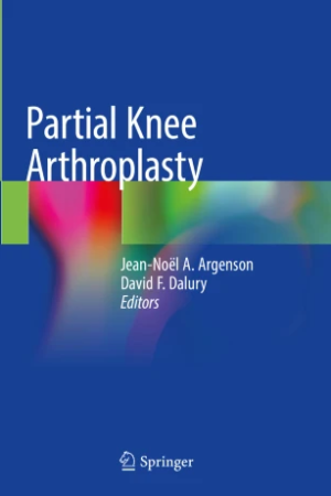 Partial Knee Arthroplasty PDF