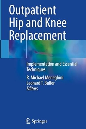 Outpatient Hip and Knee Replacement: Implementation and Essential Techniques PDF