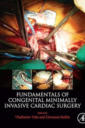 Fundamentals of Congenital Minimally Invasive Cardiac Surgery PDF