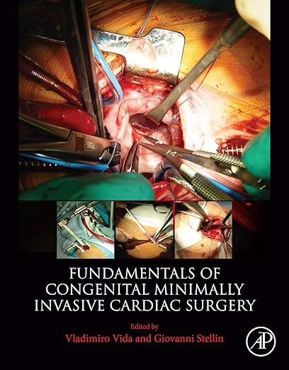 Fundamentals of Congenital Minimally Invasive Cardiac Surgery PDF