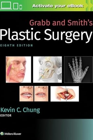 Grabb and Smith’s Plastic Surgery 8th Edition PDF