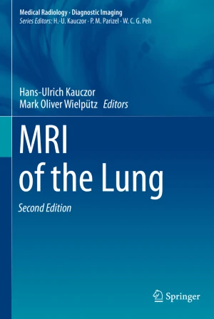 MRI of the Lung 2e PDF