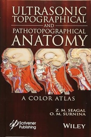 Ultrasonic Topographical And Pathotopographical Anatomy: A Color Atlas PDF