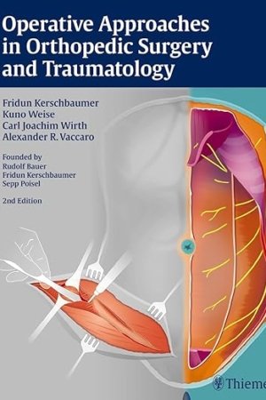 Operative Approaches in Orthopedic Surgery and Traumatology 2nd Edition PDF