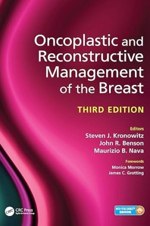 Oncoplastic and Reconstructive Management of the Breast PDF