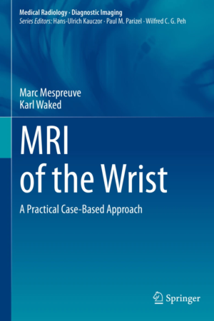 MRI of the Wrist