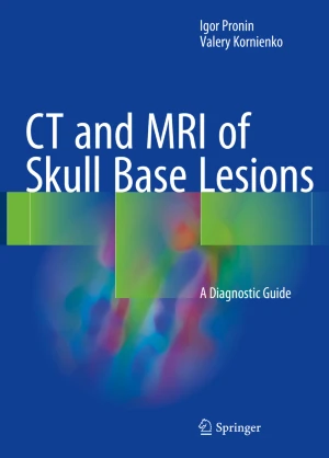 CT and MRI of Skull Base Lesions: A Diagnostic Guide PDF