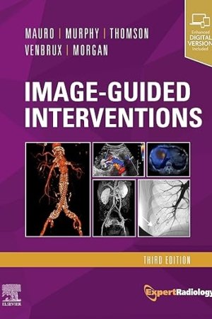 Image-Guided Interventions: Expert Radiology Series 3E PDF