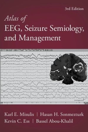 Atlas of EEG Seizure Semiology and Management 3rd Edition