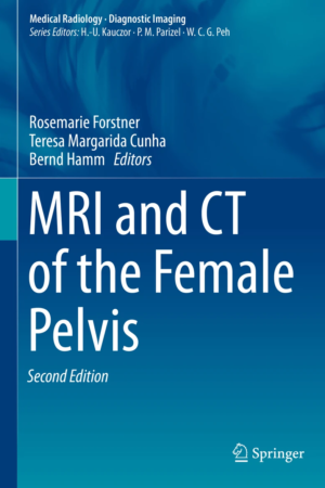 MRI and CT of the Female Pelvis 2nd Edition