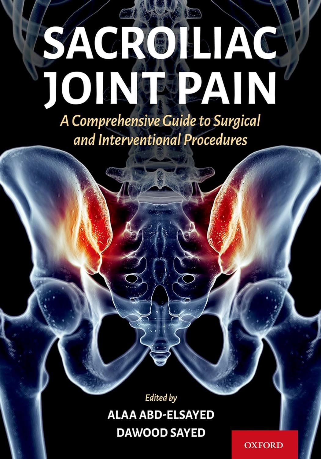 Sacroiliac Joint Pain: A Comprehensive Guide to Interventional and Surgical Procedures