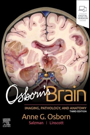 Osborn's Brain 3rd Edition