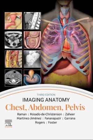Imaging Anatomy: Chest Abdomen Pelvis 3rd Edition