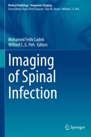 Imaging of Spinal Infection PDF