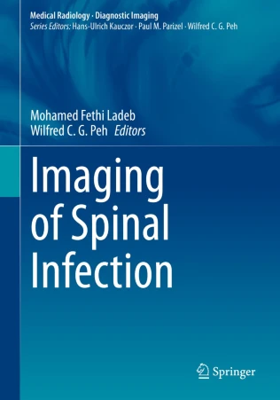 Imaging of Spinal Infection PDF