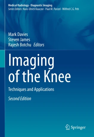 Imaging of the Knee: Techniques and Applications 2E PDF