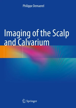 Imaging of the Scalp and Calvarium PDF