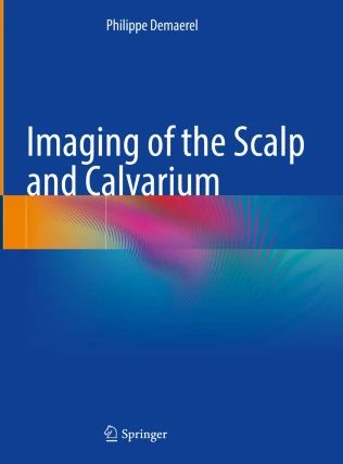 Imaging of the Scalp and Calvarium PDF