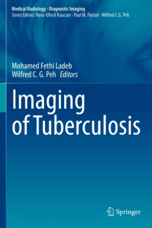 Imaging of Tuberculosis PDF