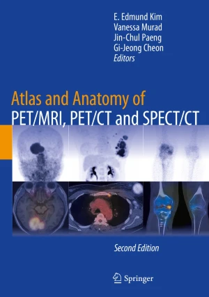 Atlas and Anatomy of PET/MRI, PET/CT and SPECT/CT 2E PDF