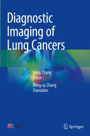 Diagnostic Imaging of Lung Cancers PDF