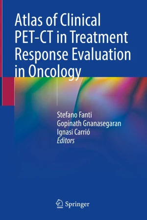 Atlas of Clinical PET-CT in Treatment Response Evaluation in Oncology PDF