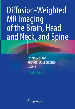 Diffusion-Weighted MR Imaging of the Brain, Head and Neck, and Spine 3e PDF