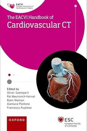 EACVI Handbook of Cardiovascular CT PDF