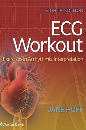 ECG Workout: Exercises in Arrhythmia Interpretation 8e PDF