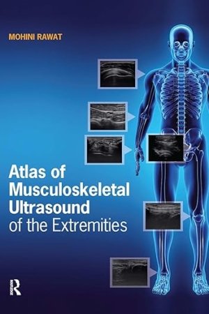 Atlas of Musculoskeletal Ultrasound of the Extremities PDF