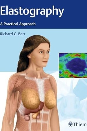 Elastography: A Practical Approach PDF