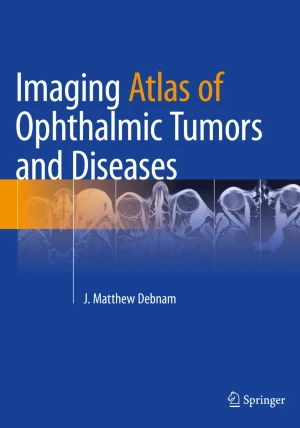 Imaging Atlas of Ophthalmic Tumors and Diseases PDF