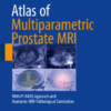 Atlas of Multiparametric Prostate MRI With PI-RADS Approach and Anatomic-MRI-Pathological Correlation PDF