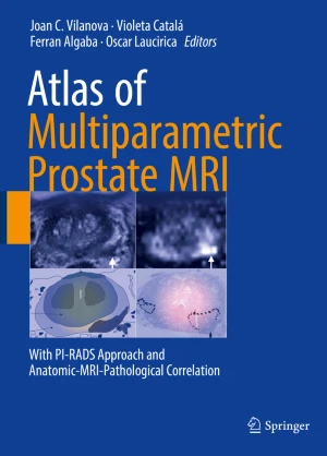 Atlas of Multiparametric Prostate MRI With PI-RADS Approach and Anatomic-MRI-Pathological Correlation PDF
