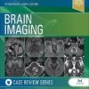 Brain Imaging: Case Review Series 3E PDF