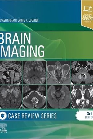 Brain Imaging: Case Review Series 3E PDF