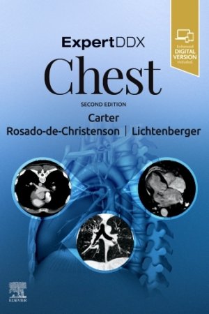 ExpertDDx: Chest, 2E PDF