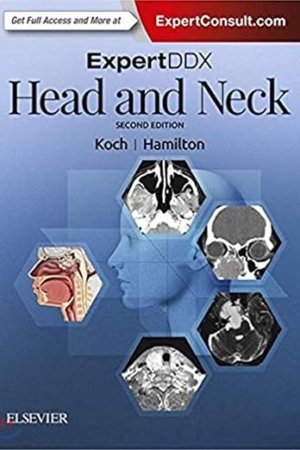 ExpertDDX: Head and Neck 2E PDF