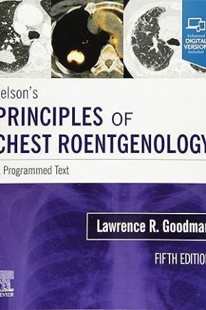Felson's Principles of Chest Roentgenology, A Programmed Text 5E PDF
