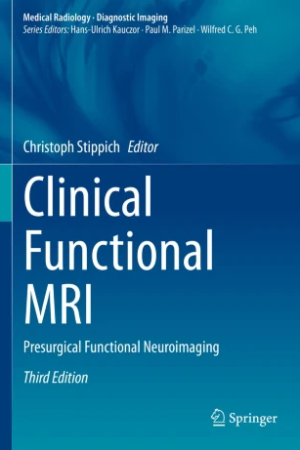 Clinical Functional MRI: Presurgical Functional Neuroimaging 3e PDF