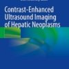 Contrast-Enhanced Ultrasound Imaging of Hepatic Neoplasms PDF