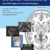 Cranial Neuroimaging and Clinical Neuroanatomy 4E PDF