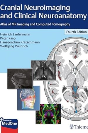 Cranial Neuroimaging and Clinical Neuroanatomy 4E PDF